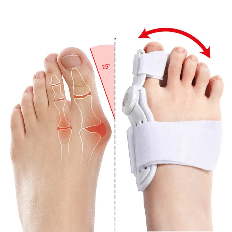 ToeAligner™ | Sekundenschnelle Linderung bei Ballenzehen!