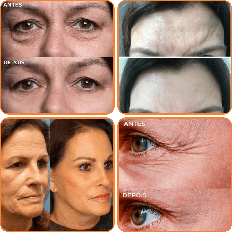 1+1 Gratis | SleekSkin™ | Alterslose Schönheit Ausstrahlung [Letzter Tag Rabatt]