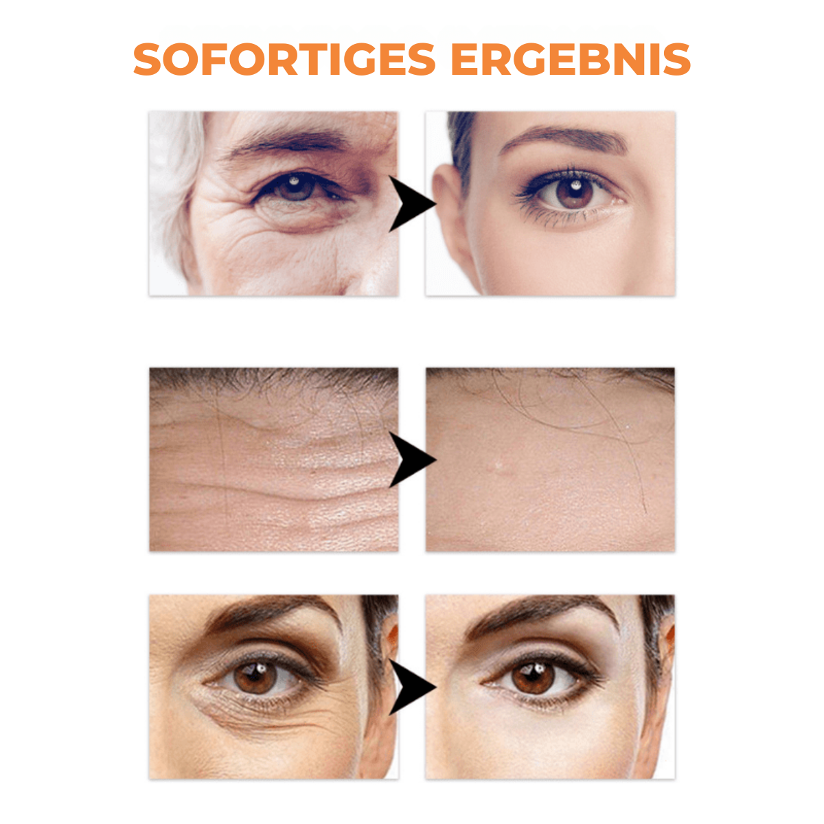 1+1 Gratis | SleekSkin™ | Alterslose Schönheit Ausstrahlung [Letzter Tag Rabatt]