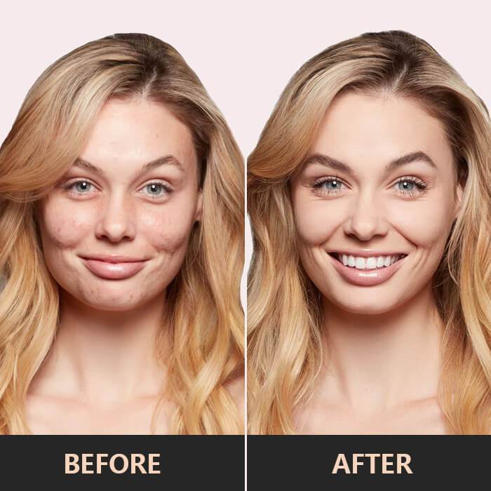 50% Rabatt | ToneBlend™ | 100G Multifunktionale Concealer Palette