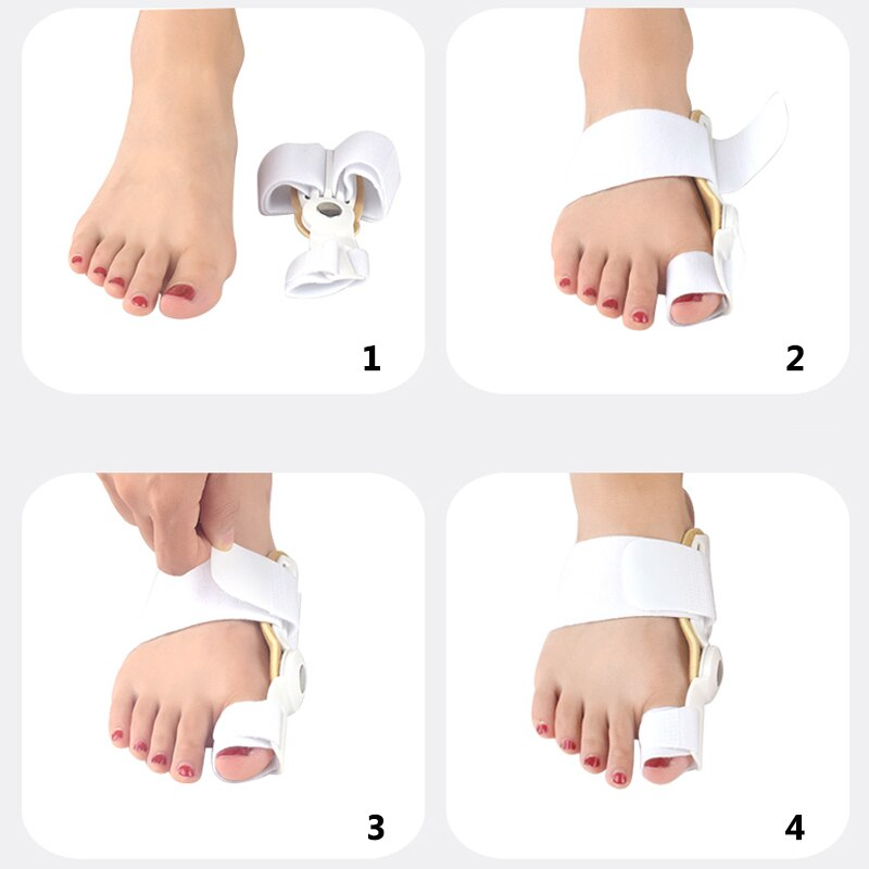 ToeAligner™ | Sekundenschnelle Linderung bei Ballenzehen!