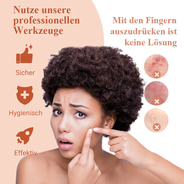 ClearSkin™ | Präzise Entfernung von Mitessern