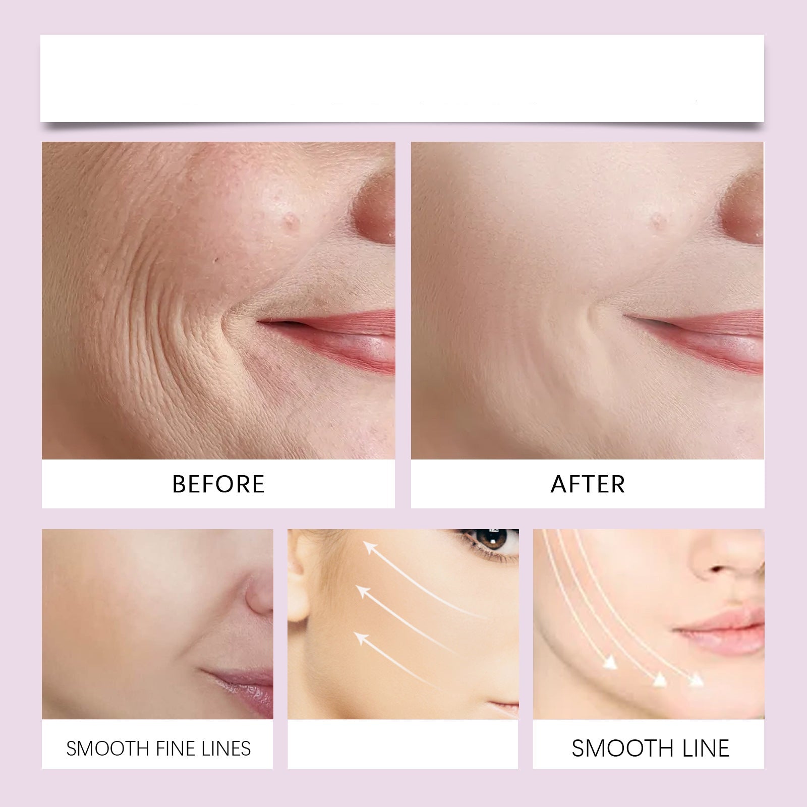 LuxLift™ | Heb dein Kinn, strahle Jugendlichkeit aus ohne OP!