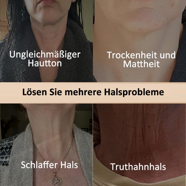 1+1 Gratis | Firmify™ | Straffende Hals- und Körpercreme