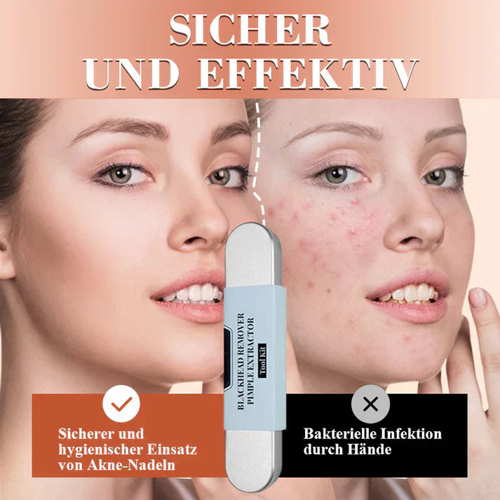 ClearSkin™ | Präzise Entfernung von Mitessern