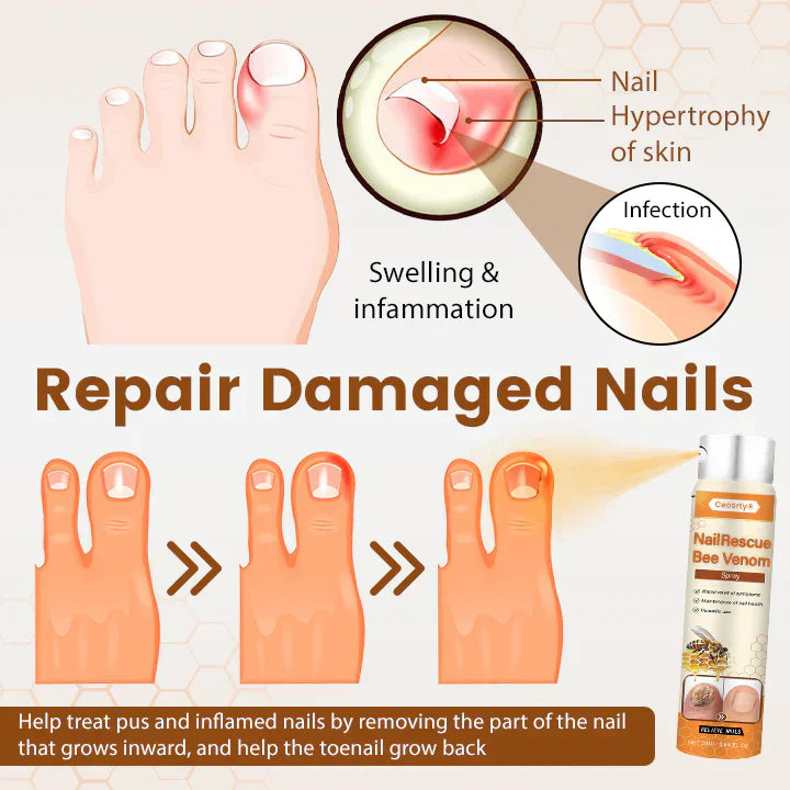 1+1 Gratis | NailRescue™ | Schnelle Heilung, Starkes Nagelbild