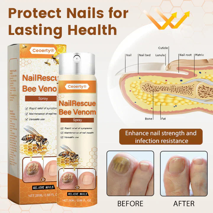 1+1 Gratis | NailRescue™ | Schnelle Heilung, Starkes Nagelbild