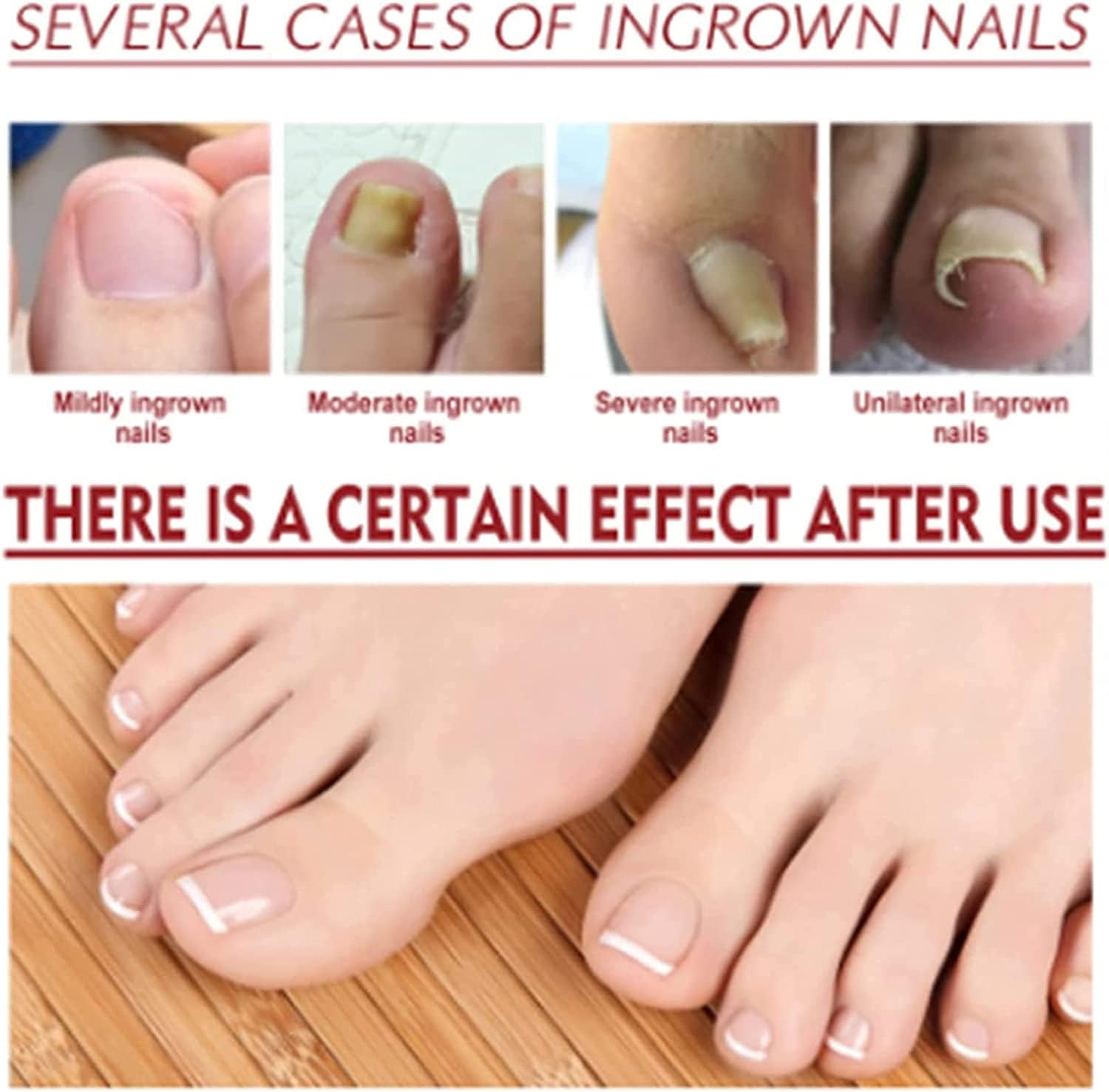 1+1 Gratis | HeilungsTropfen™ | Beschädigte Nägel in 4 Wochen wiederherstellen