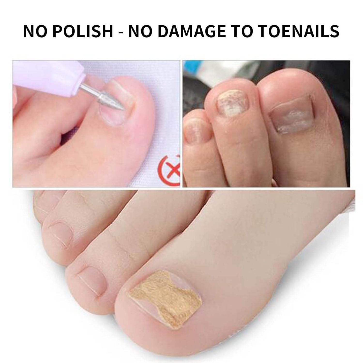10+10 Gratis | FixaNail | Sofortige Nagelreparatur