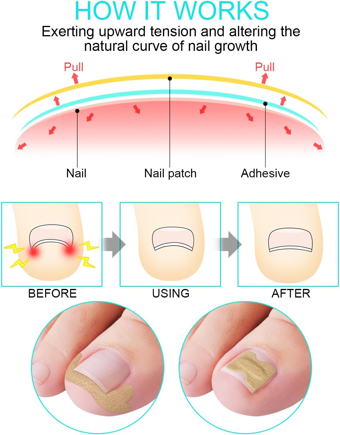 10+10 Gratis | FixaNail | Sofortige Nagelreparatur