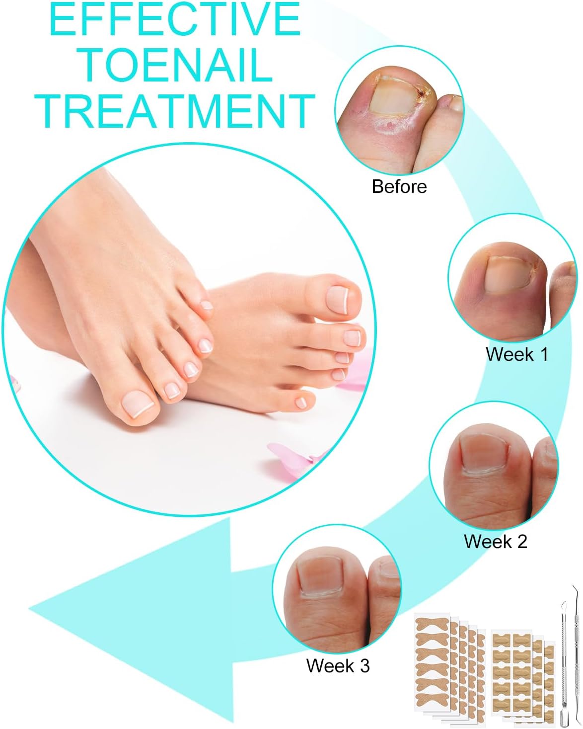 10+10 Gratis | FixaNail | Sofortige Nagelreparatur