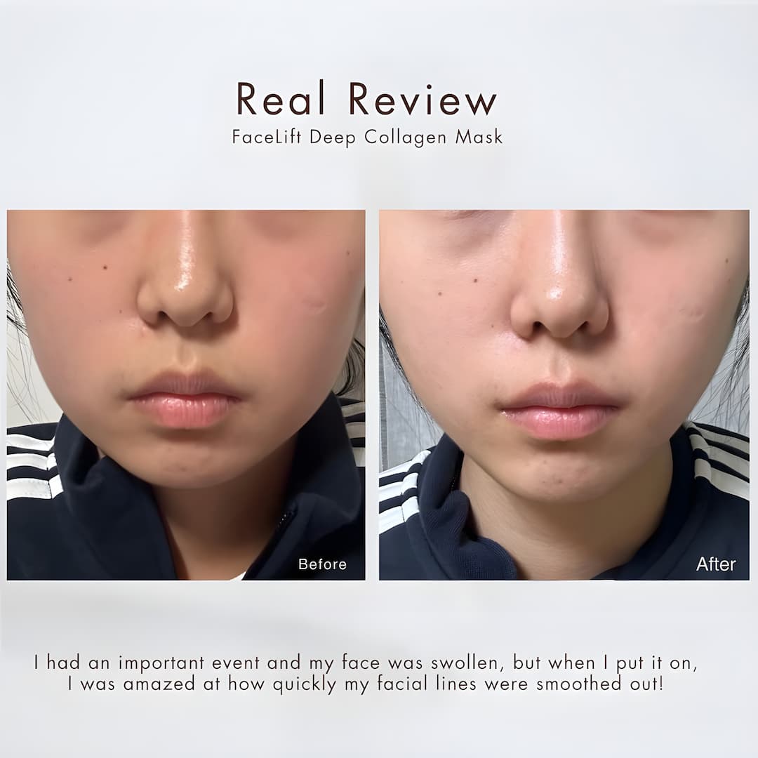 50% Rabatt | HydraMask™ | Sofortige, intensive und effektive Hautstraffung
