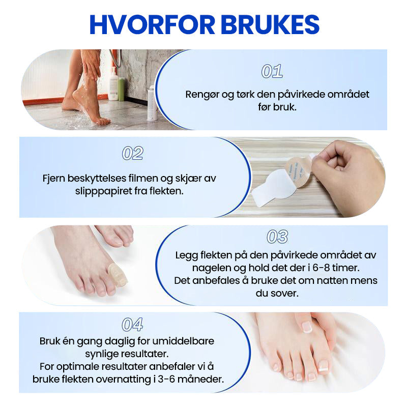 1+1 Gratis | Nailox™  | Wirksame Behandlung von Nagelpilz