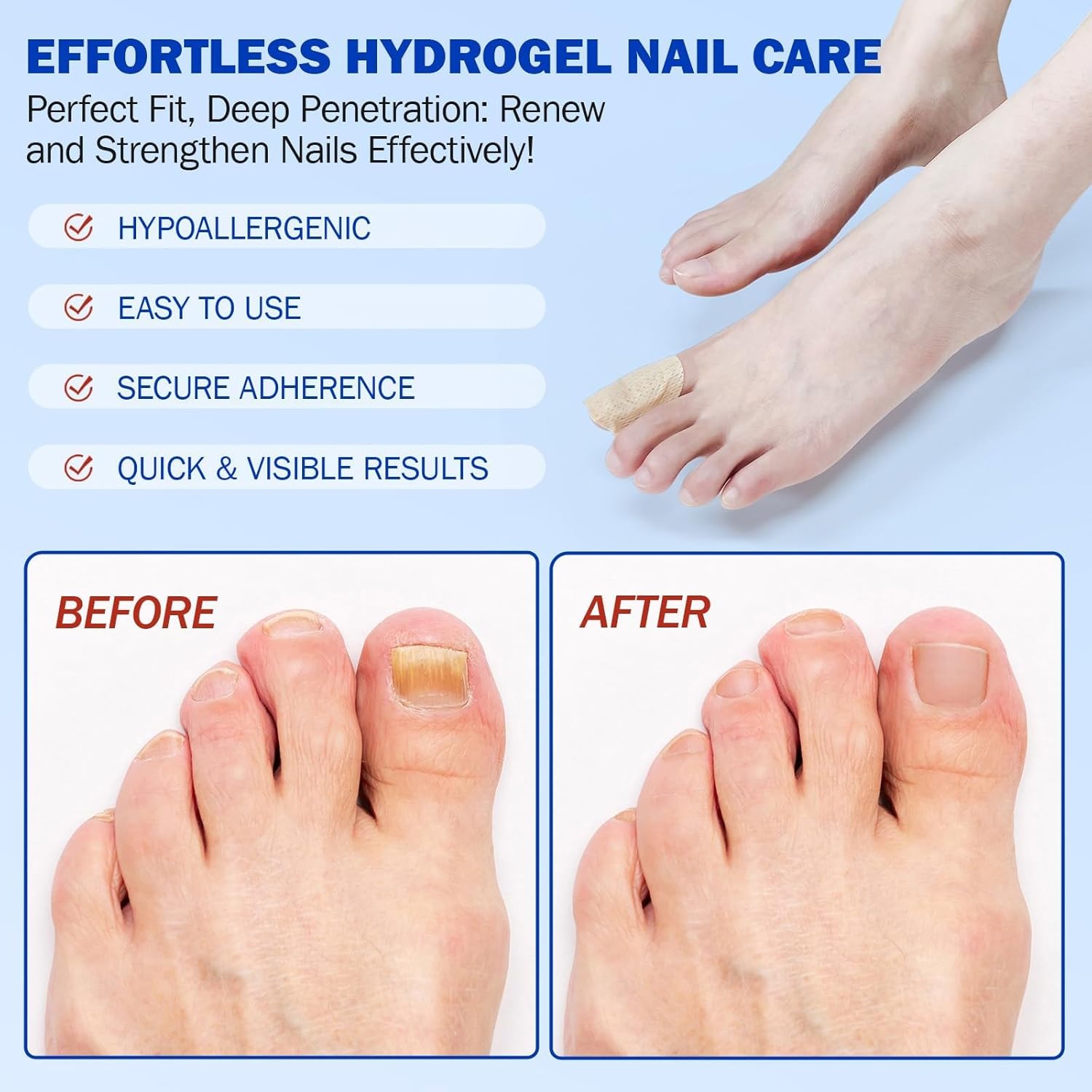 PureNail™ | Optimale Wiederherstellung Ihrer Nägel