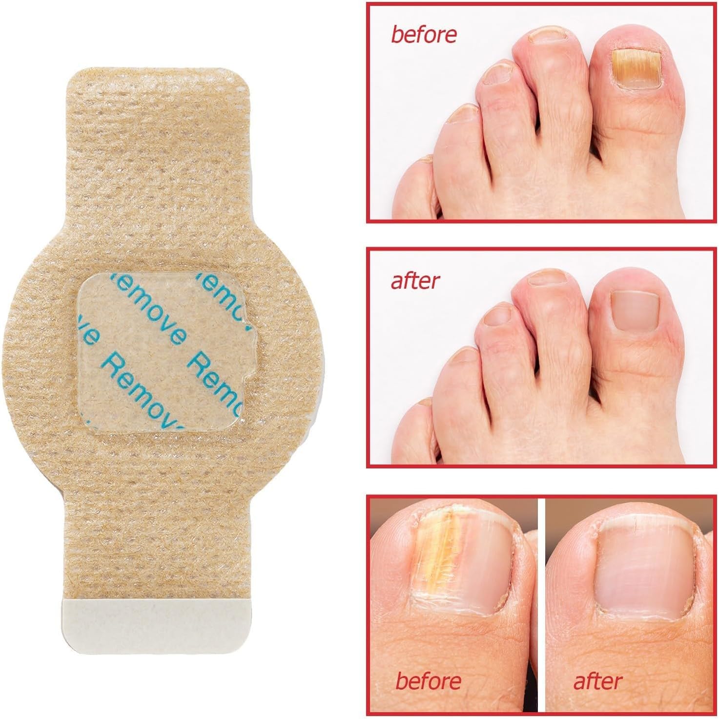 PureNail™ | Optimale Wiederherstellung Ihrer Nägel