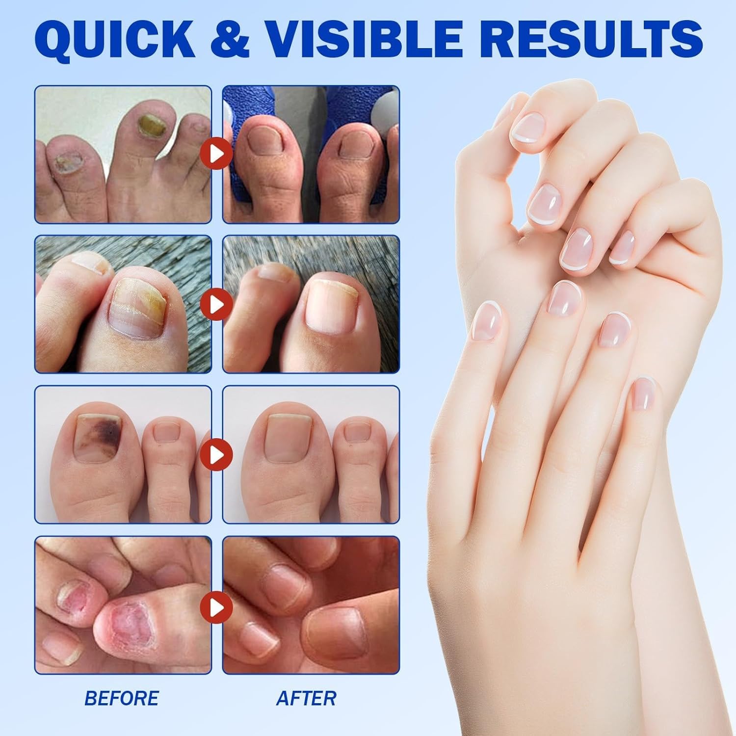 PureNail™ | Optimale Wiederherstellung Ihrer Nägel