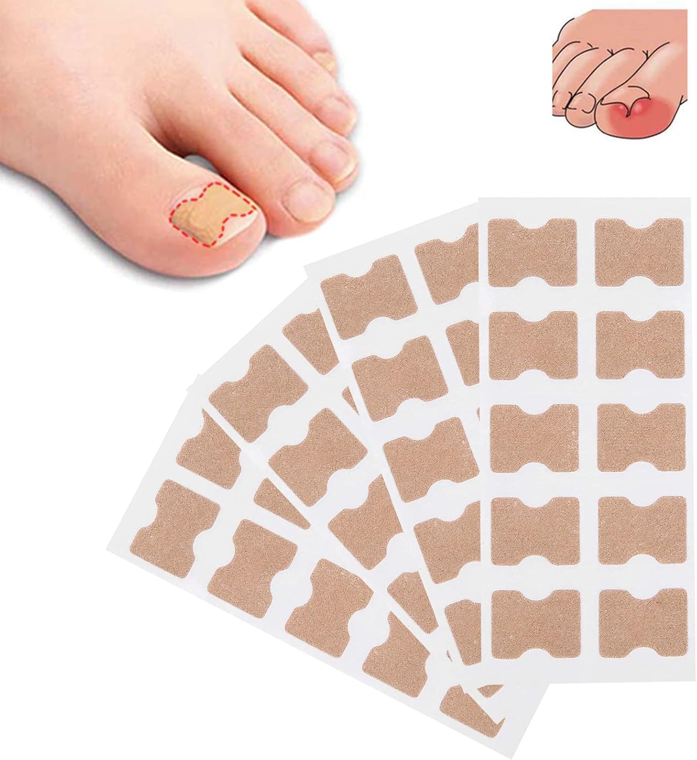 10+10 Gratis | FixaNail | Sofortige Nagelreparatur
