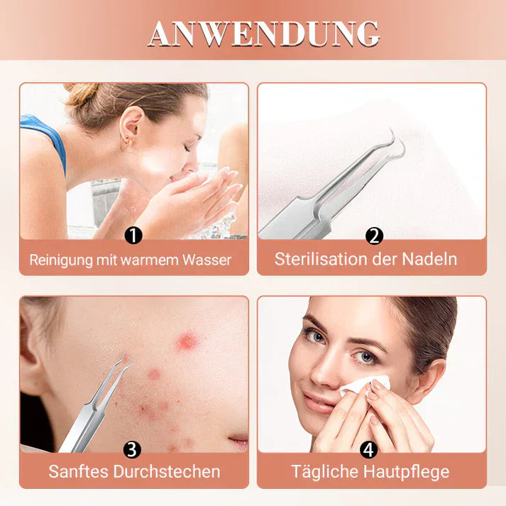ClearSkin™ | Präzise Entfernung von Mitessern