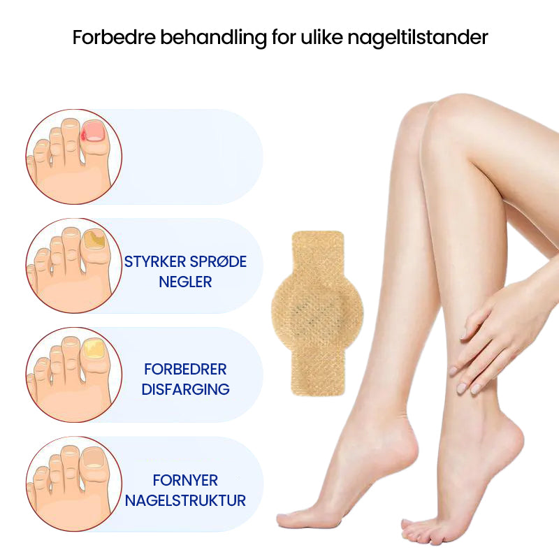 1+1 Gratis | Nailox™  | Wirksame Behandlung von Nagelpilz