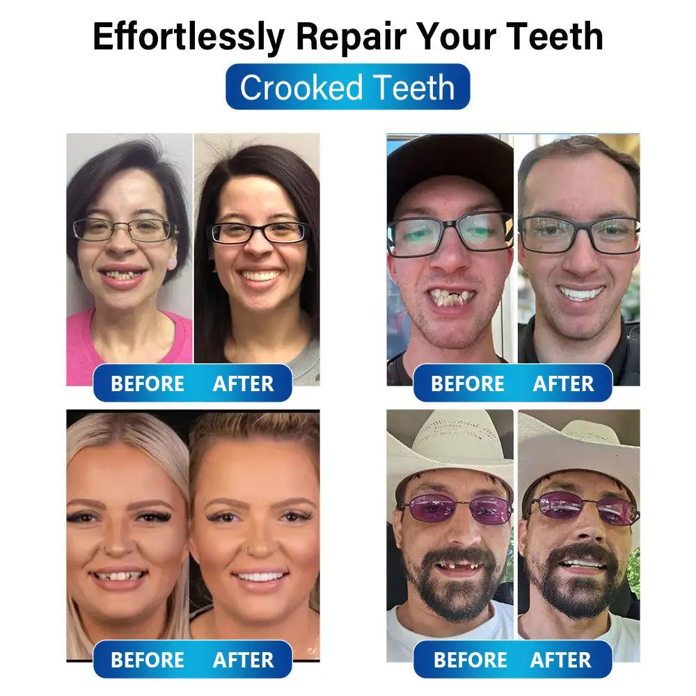 50% RABATT | Futusly™ | Professionelle Blaulicht-Härtelampe und langlebige Prothesenmaterialien