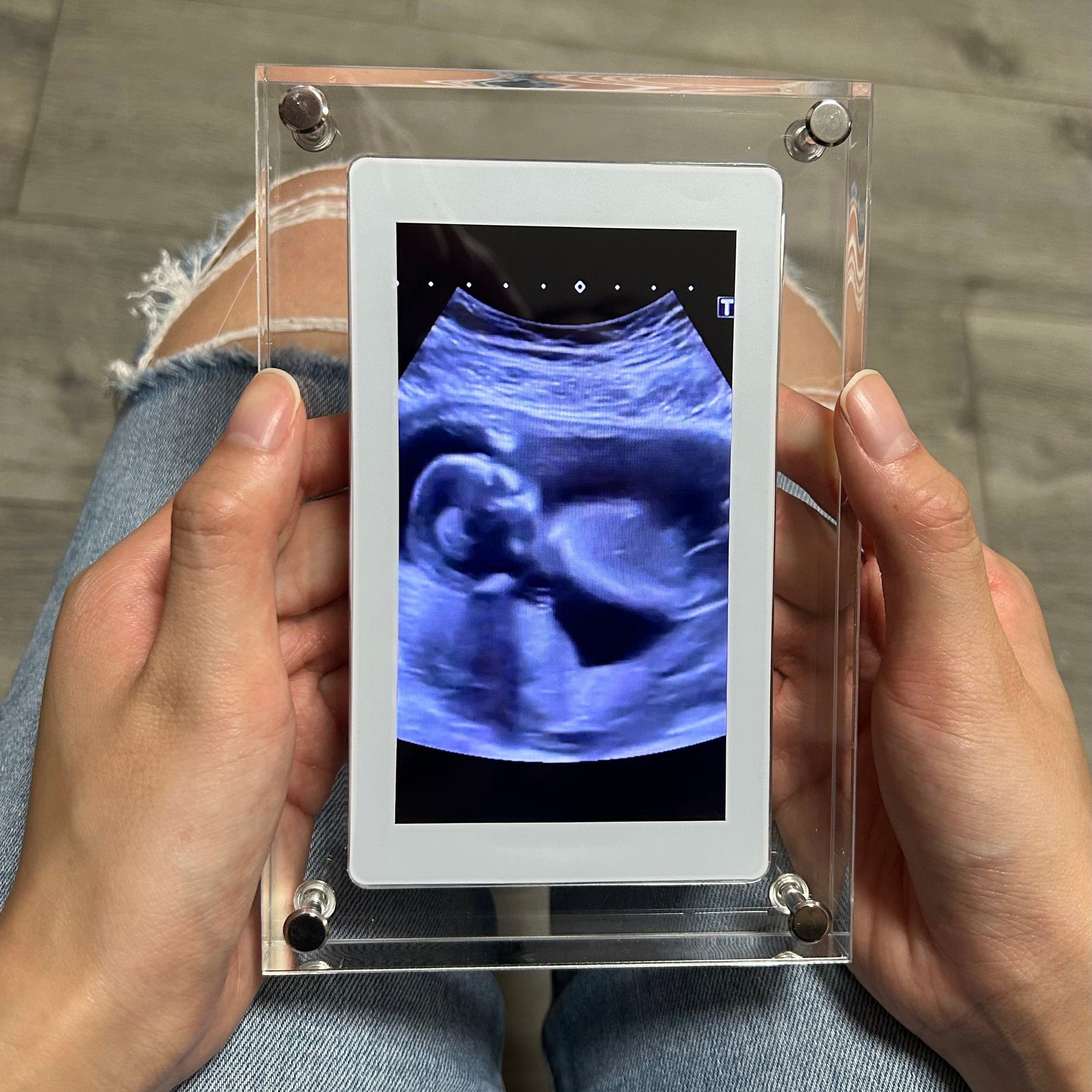 SnapFrame™ | Digitaler Bilderrahmen - Halten Sie wertvolle Momente fest und erleben Sie sie sofort!