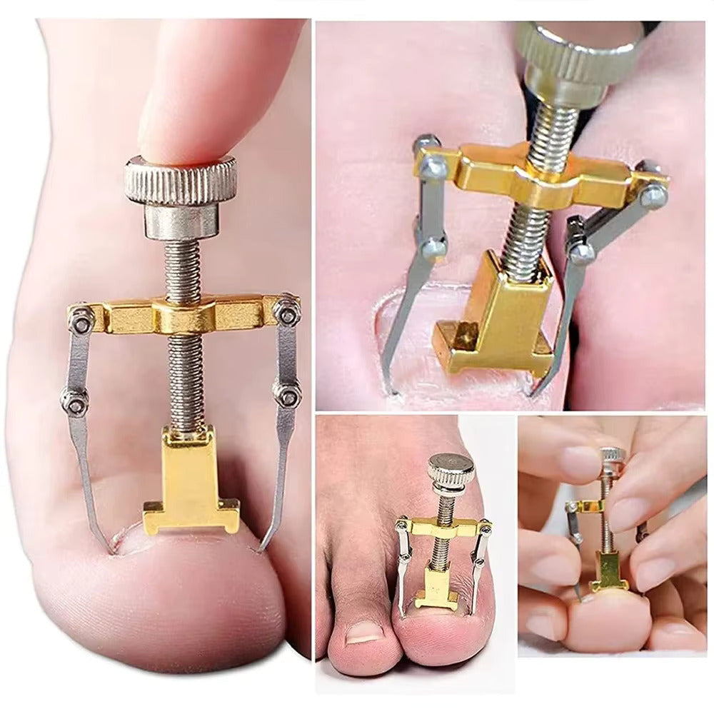 ToePrecise | Ingrown Toenail Tools Set