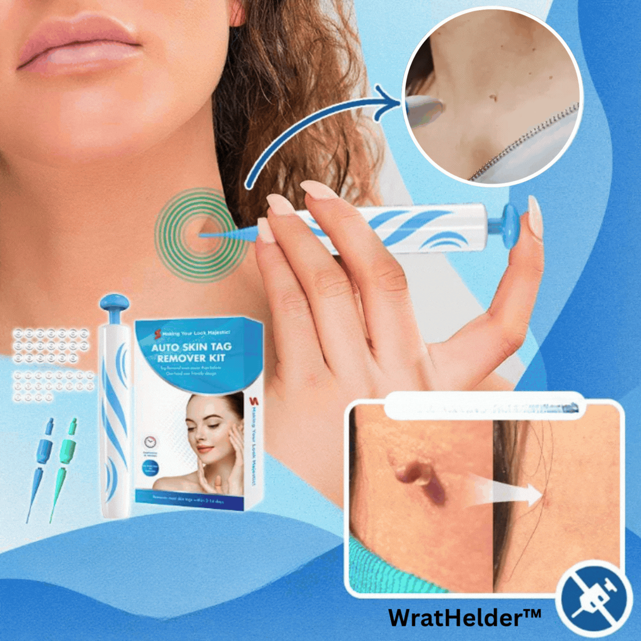 WratHelder™ | Präzise Warzenentfernung