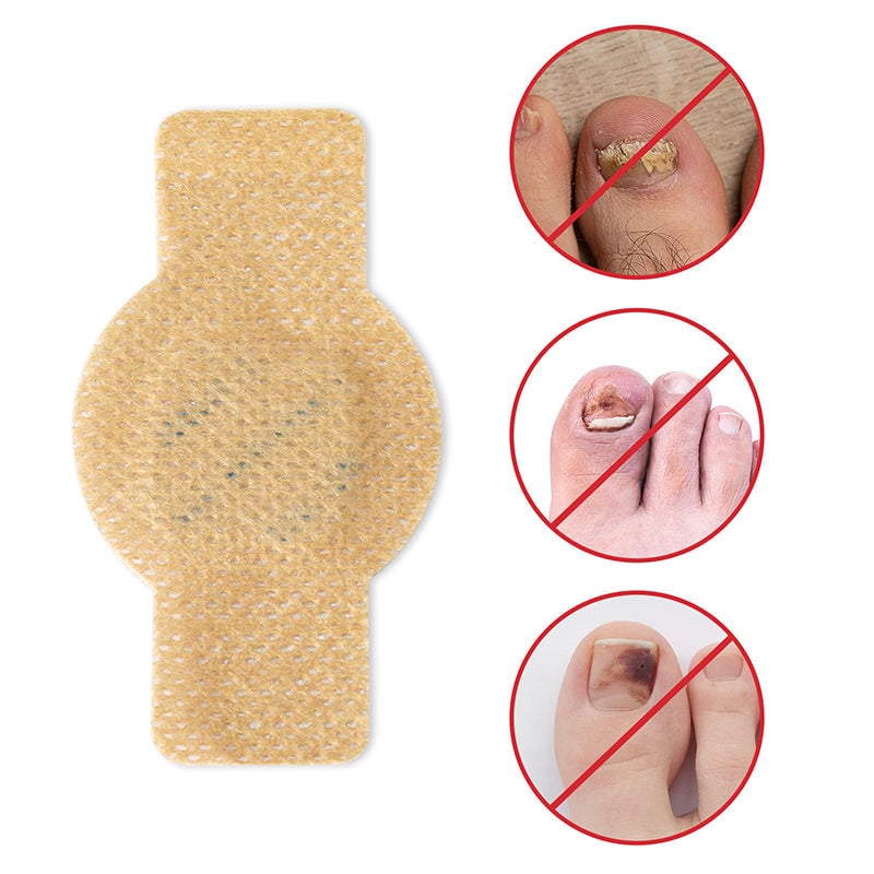 1+1 Gratis | Nailox™  | Wirksame Behandlung von Nagelpilz