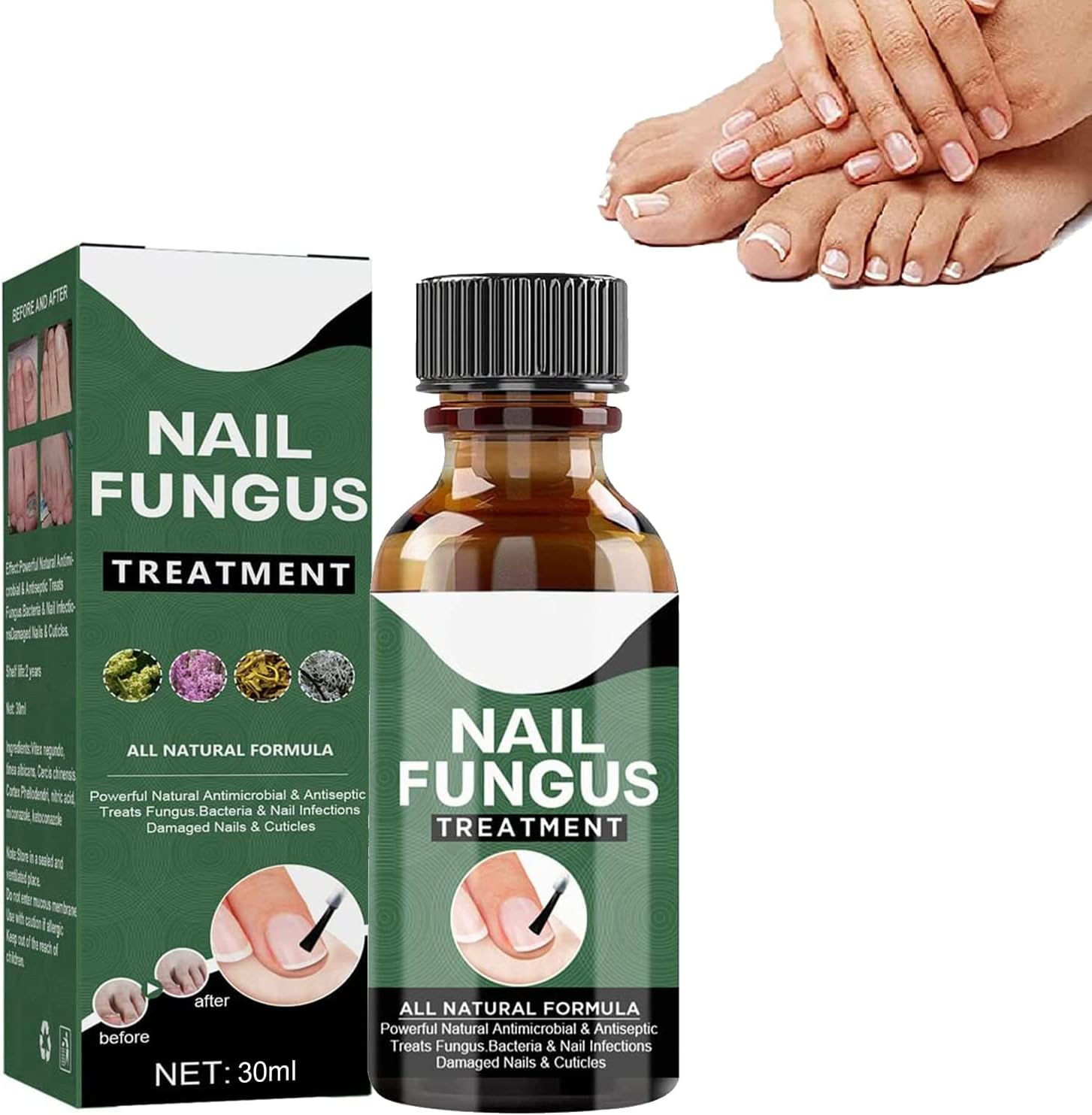 Nagelpilz-Reparaturserum | Heilt, Restauriert & Schützt Beschädigte Nägel