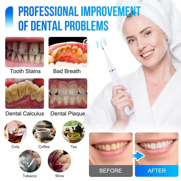 50 % Rabatt | ToothCleaner™ | Wirksame Pflege für strahlend gesunde Zähne!