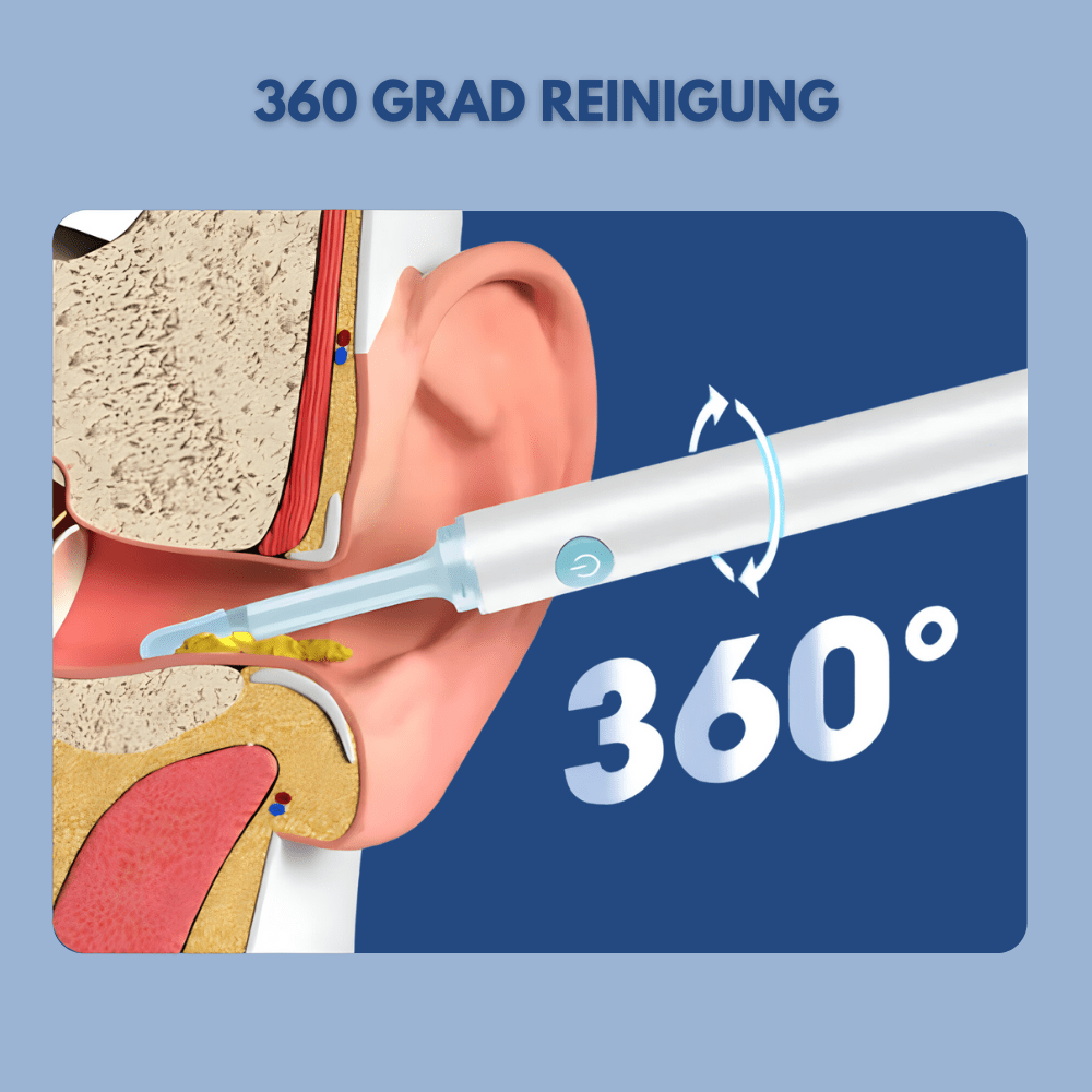 Earvana™ | Intelligenter Ohrreiniger mit Kamera