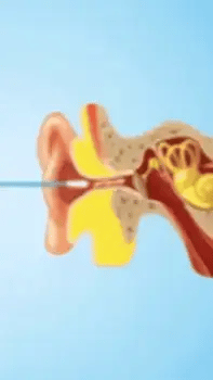 Earvana™ | Intelligenter Ohrreiniger mit Kamera