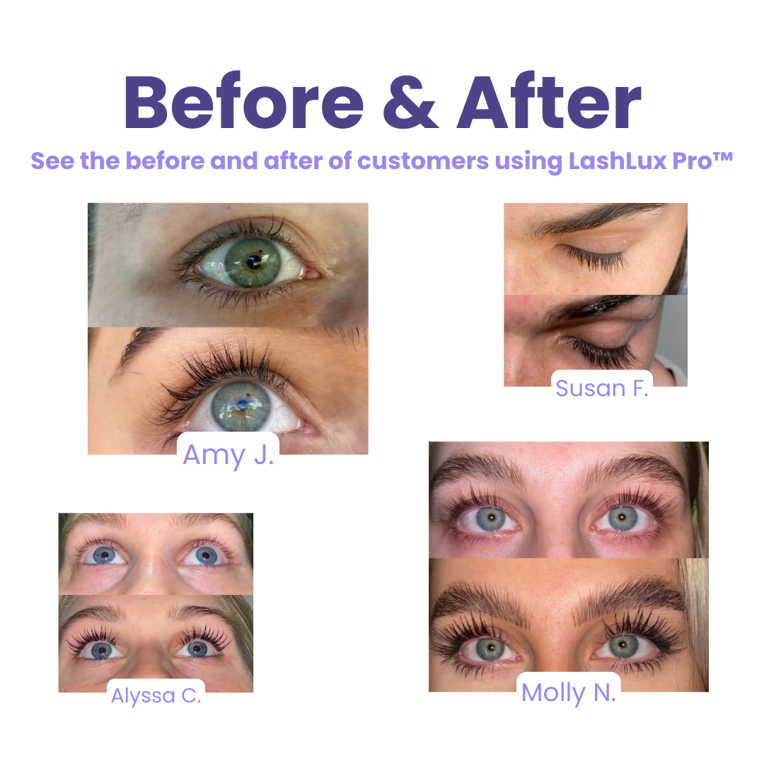 1+1 Gratis | LashLux Pro™ |  Wimpernwachstumsserum